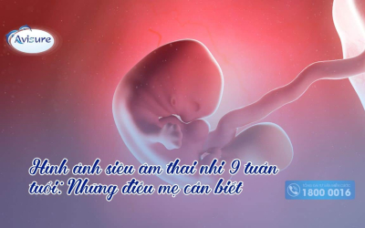 Hình ảnh siêu âm thai nhi 9 tuần tuổi: Những điều mẹ cần biết